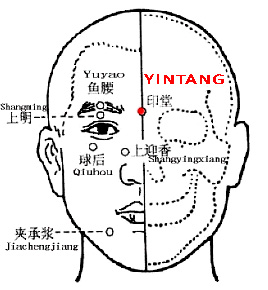 Yintang Ex-HN3