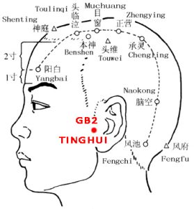 Tinghui-GB2