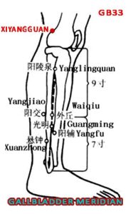 Xiyangguan GB33 lies on the lateral side of the knee, in the depression above the lateral epicondyle of the femur, between the femur and tendon of biceps femoris (3 cun above Yanglingquan/GB34).